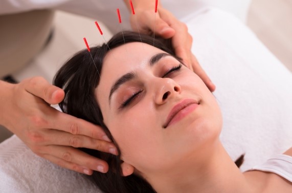 Acupuncture treatment for migraine in Dubai at Beijing Acupuncture Clinic