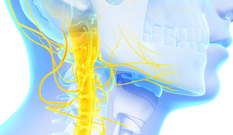 PINCHED NERVE