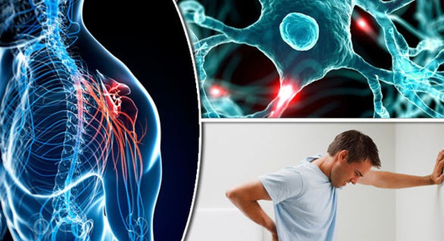 Expert Multiple Sclerosis treatment in Dubai