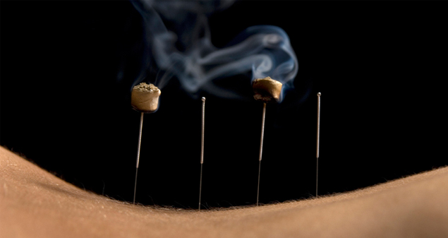 Moxibustion Acupuncture Points