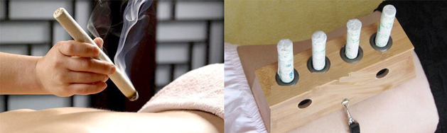 Moxibustion Treatment in Dubai
